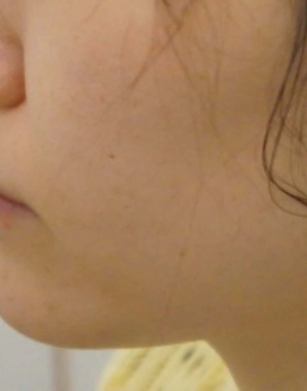before_image