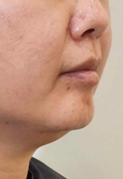 before_image