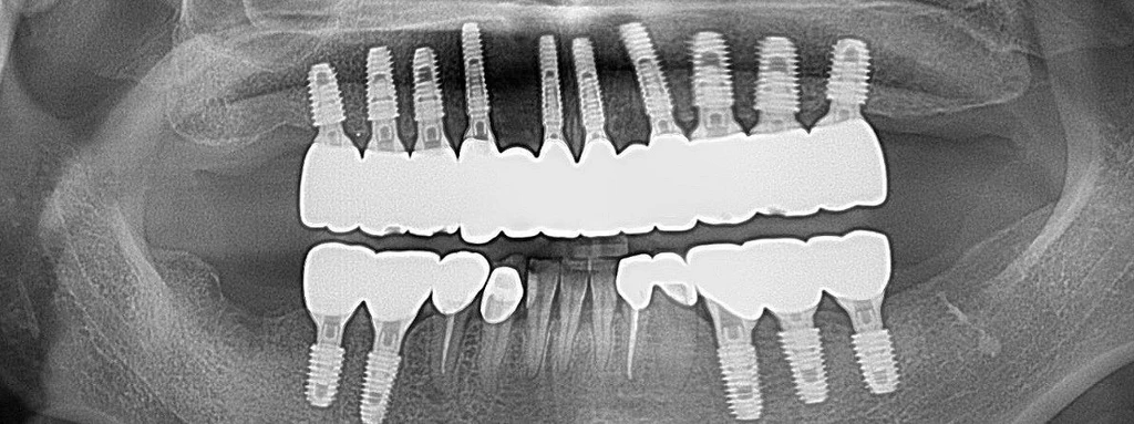 before_image