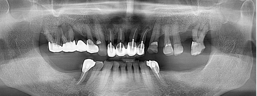 before_image