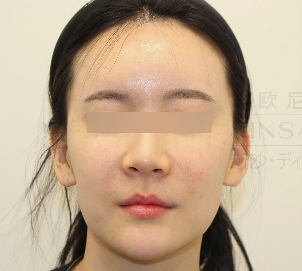 before_image