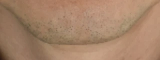 before_image
