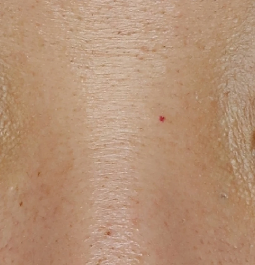 before_image