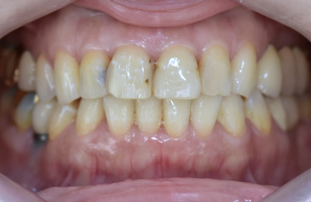 before_image