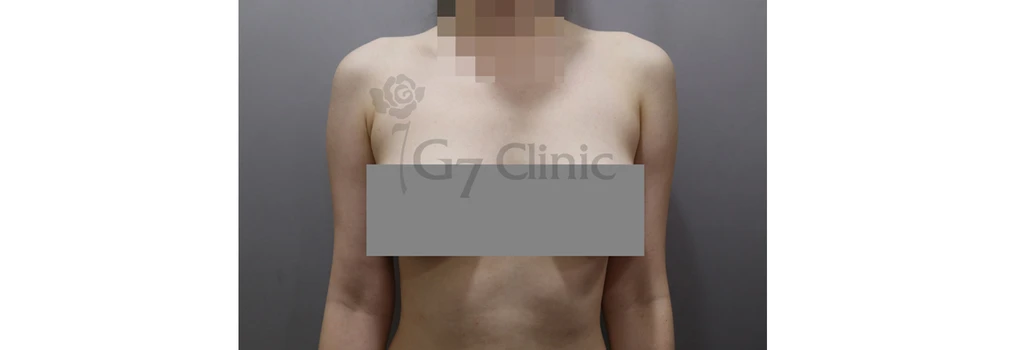 before_image