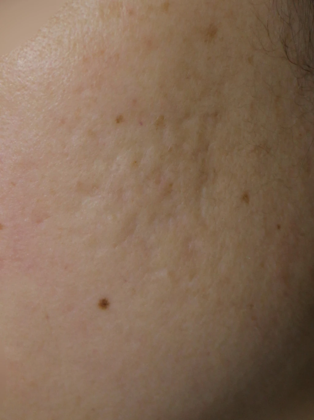 before_image