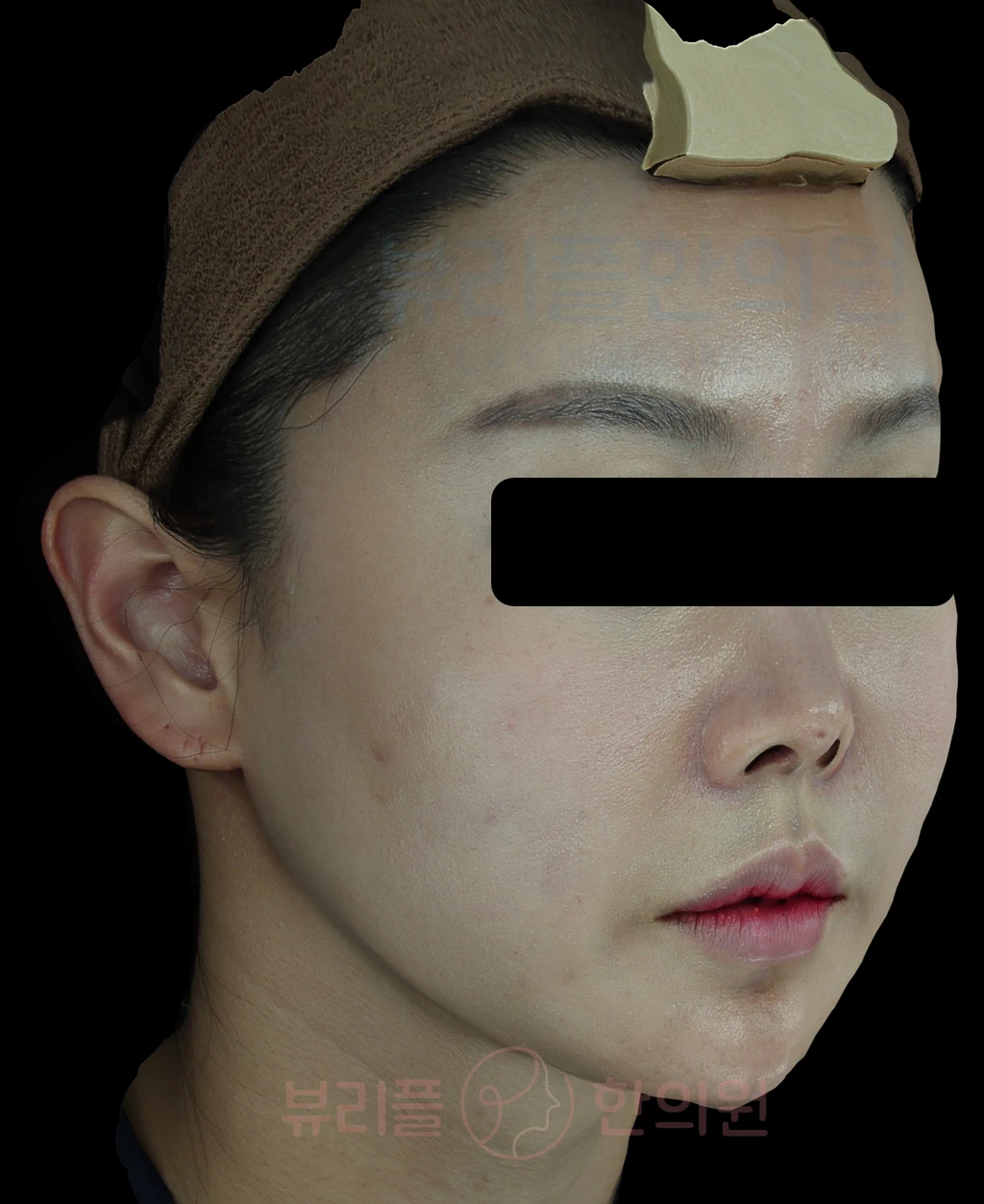before_image