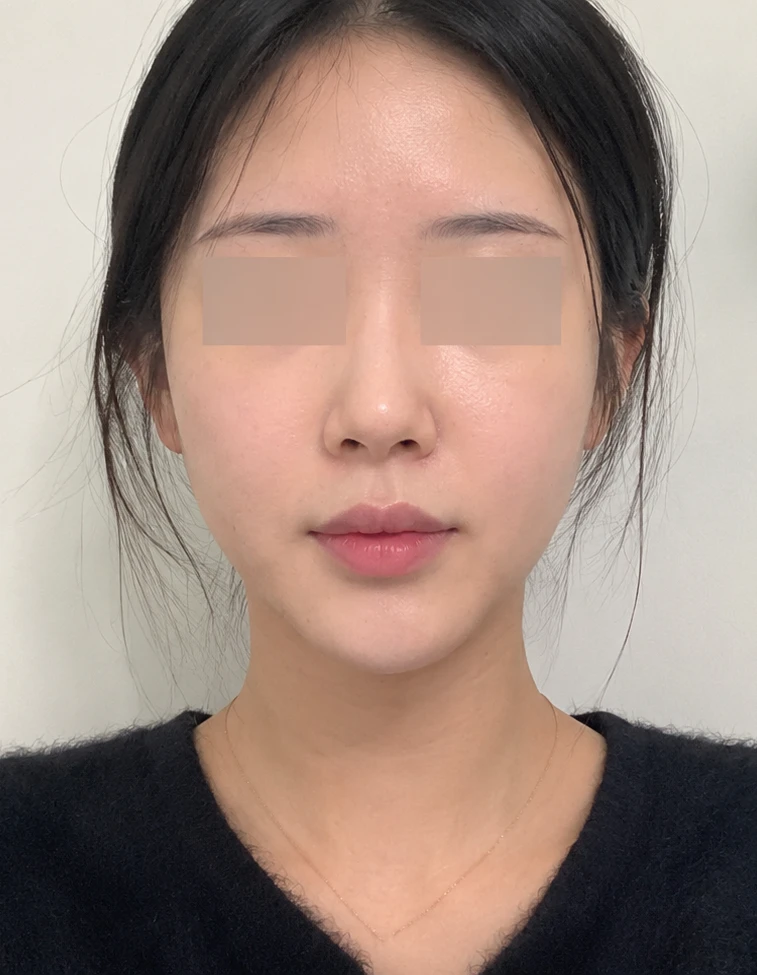 before_image