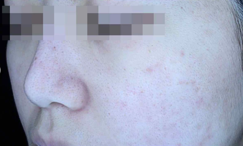 before_image