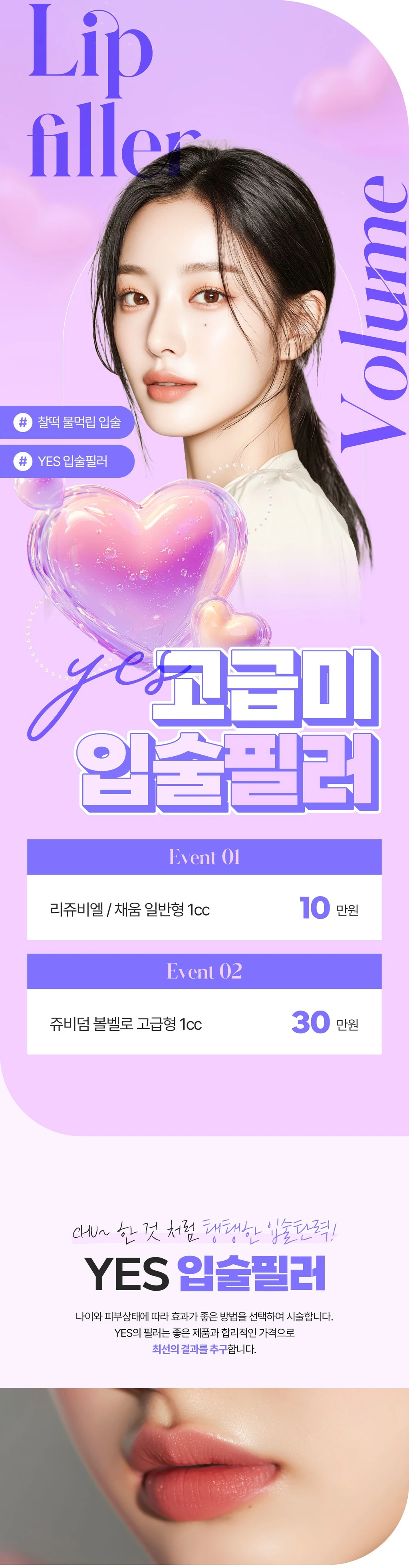 YES 고급미 입술필러 할인, 가격, 후기, 전후, 효과 정보 by 예스성형외과의원(부천) | 여신티켓 - 국내 1등 피부과, 성형외과  플랫폼