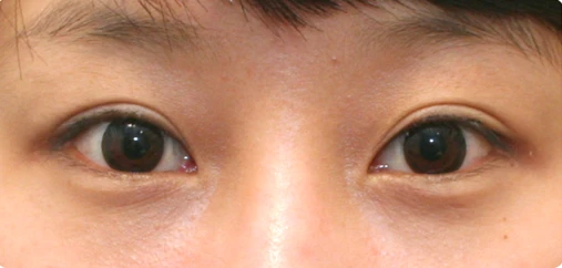 before_image