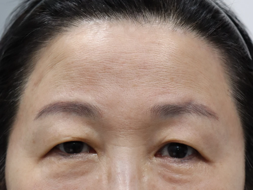 before_image