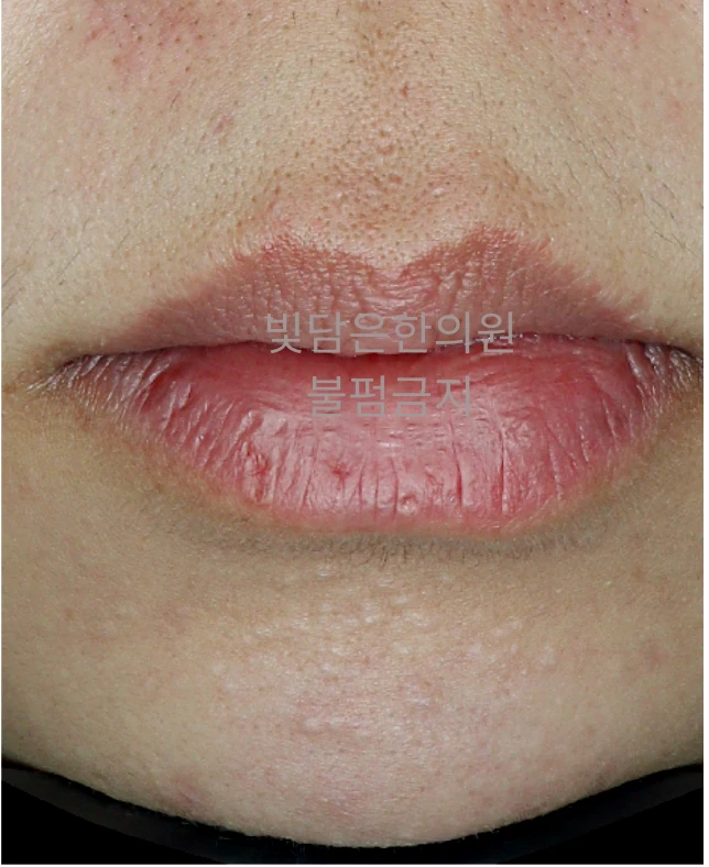 before_image