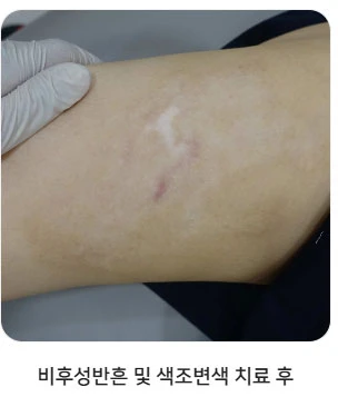 before_image