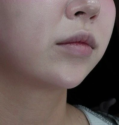 before_image