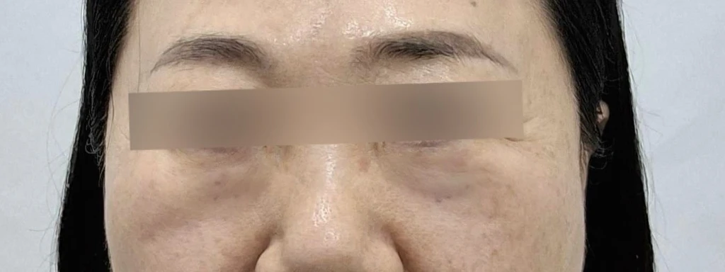 before_image