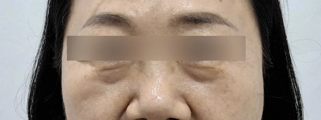 before_image