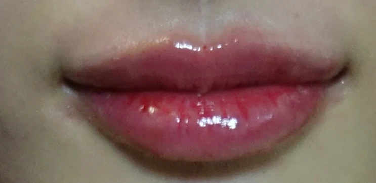before_image