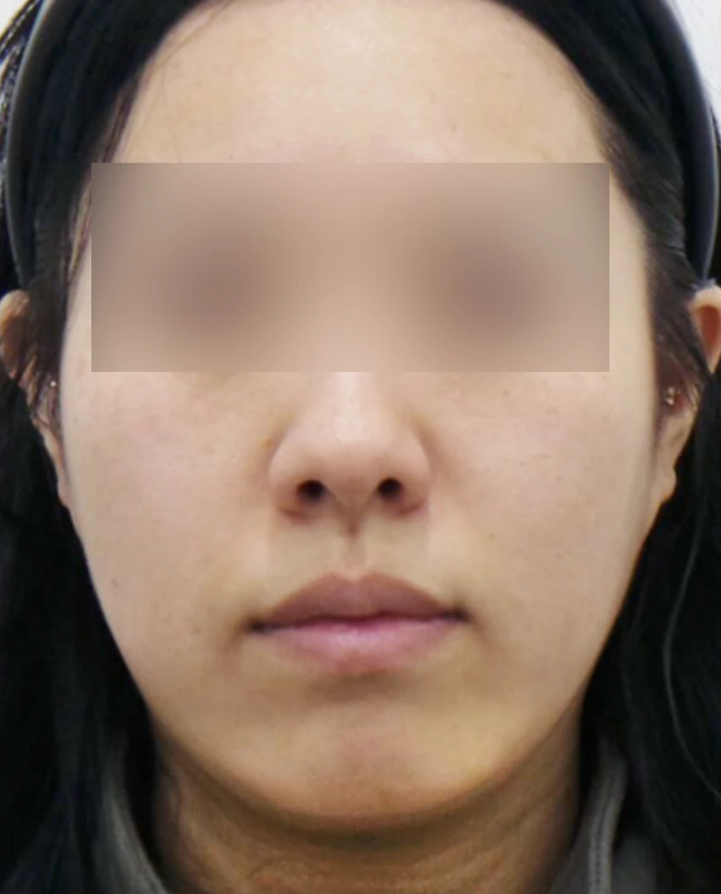 before_image