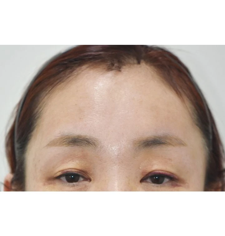 before_image