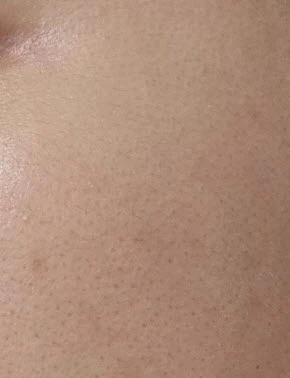 before_image