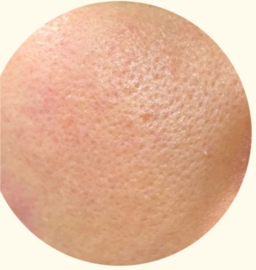 before_image