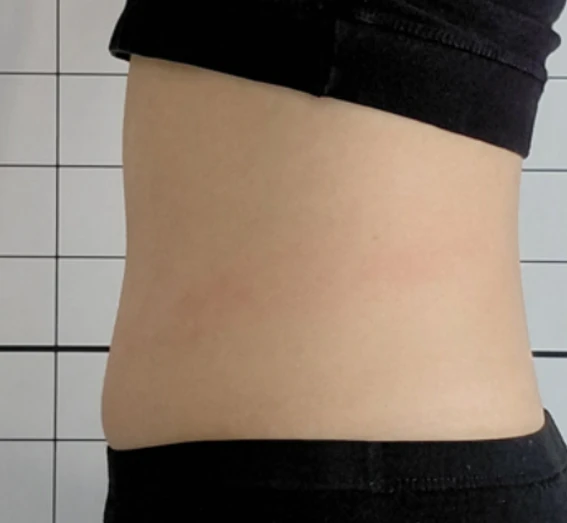 before_image