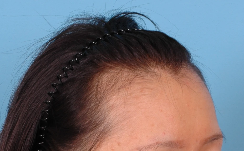 before_image