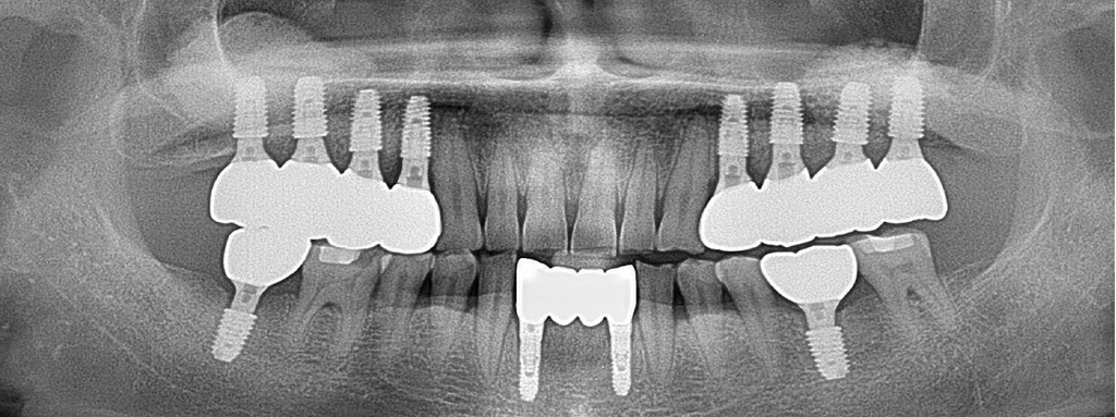 before_image