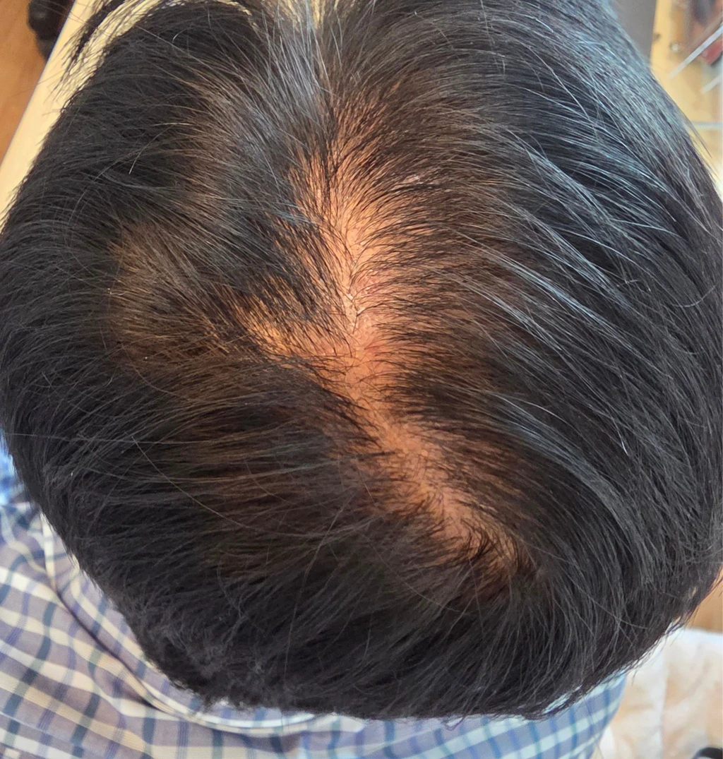 before_image