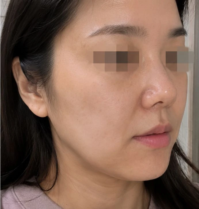 before_image