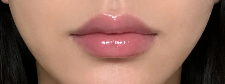 before_image