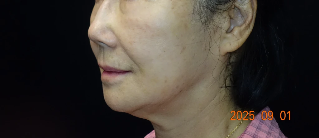 before_image