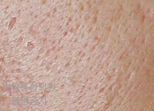 before_image