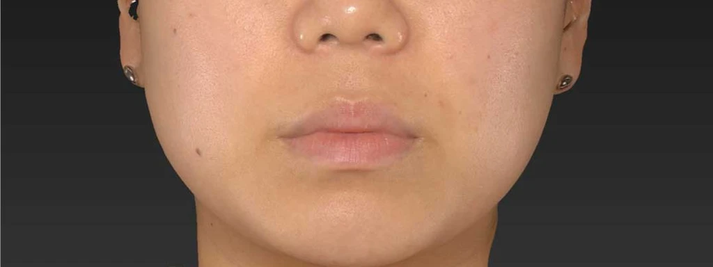 before_image