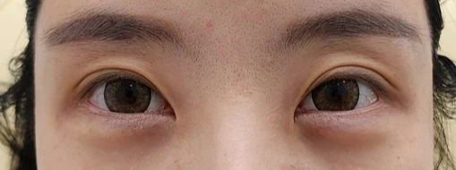 before_image