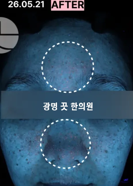 before_image
