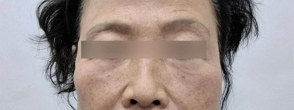 before_image