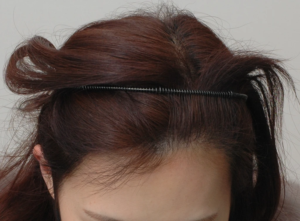 before_image