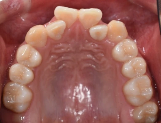 before_image