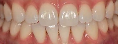 before_image