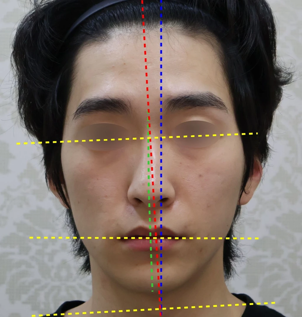 before_image