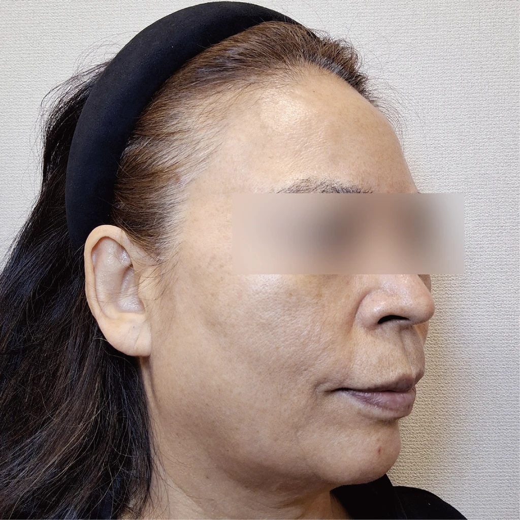 before_image