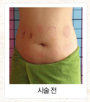 before_image