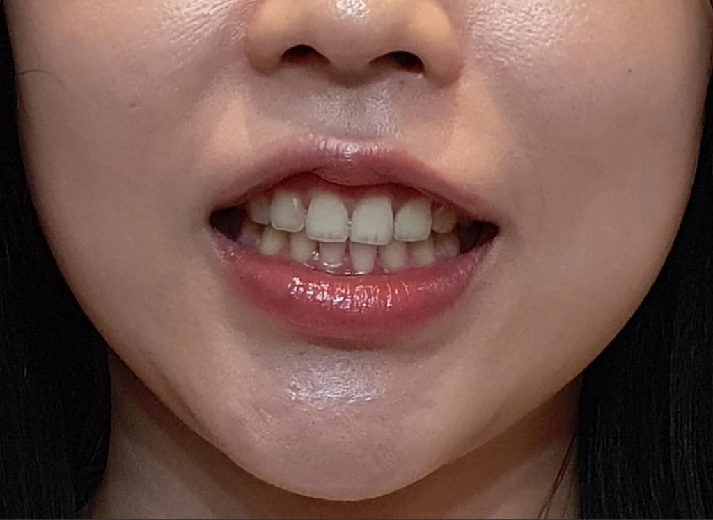 before_image