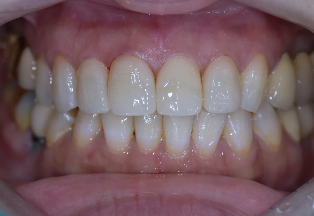 before_image