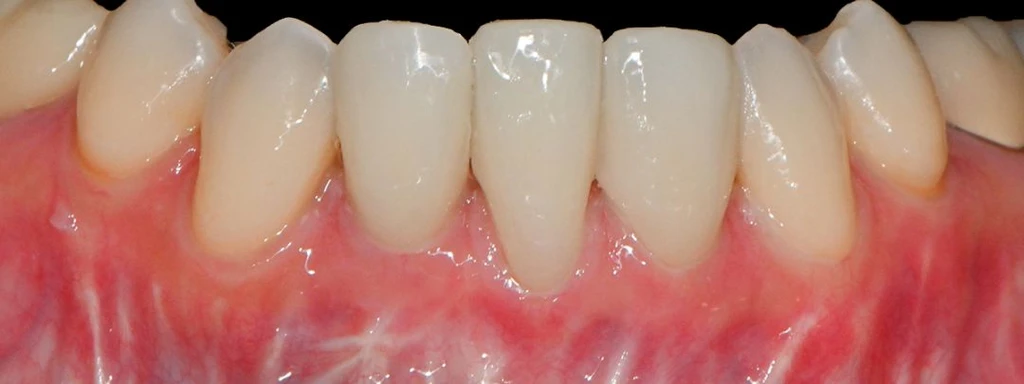 before_image