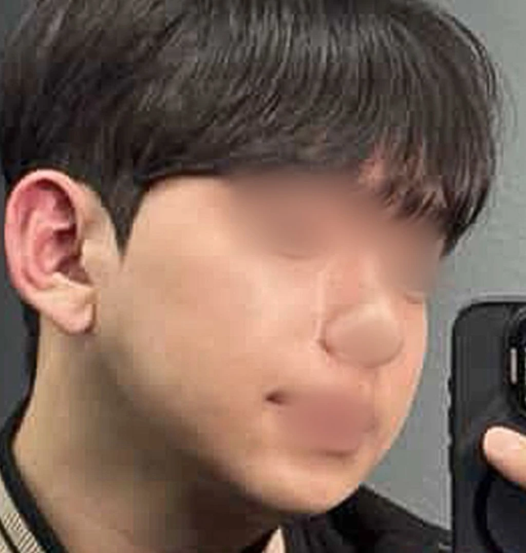 before_image