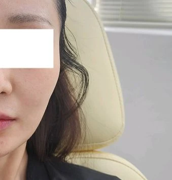 before_image