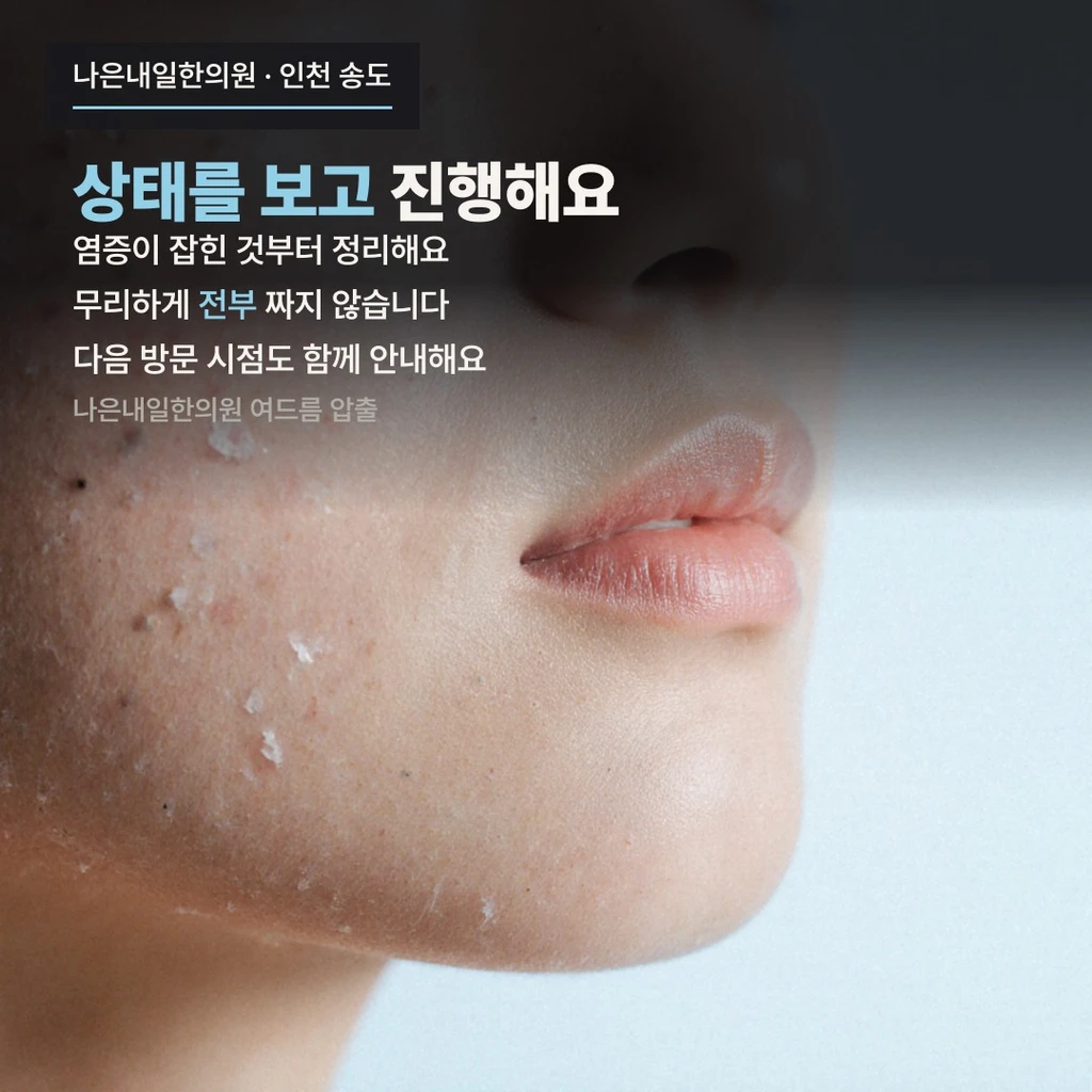 treatmentIntroduction